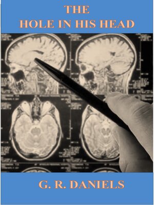 cover image of The Hole in His Head